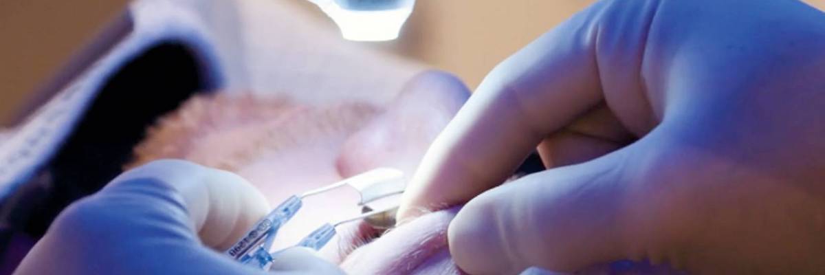 Everything You Need to Know About What Happens During LASIK Eye Surgery