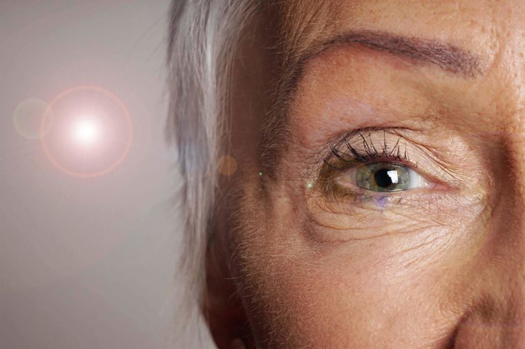 5 Facts About Age-Related Macular Degeneration