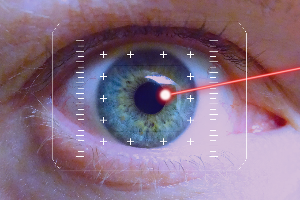 Laser Precision for Cataracts