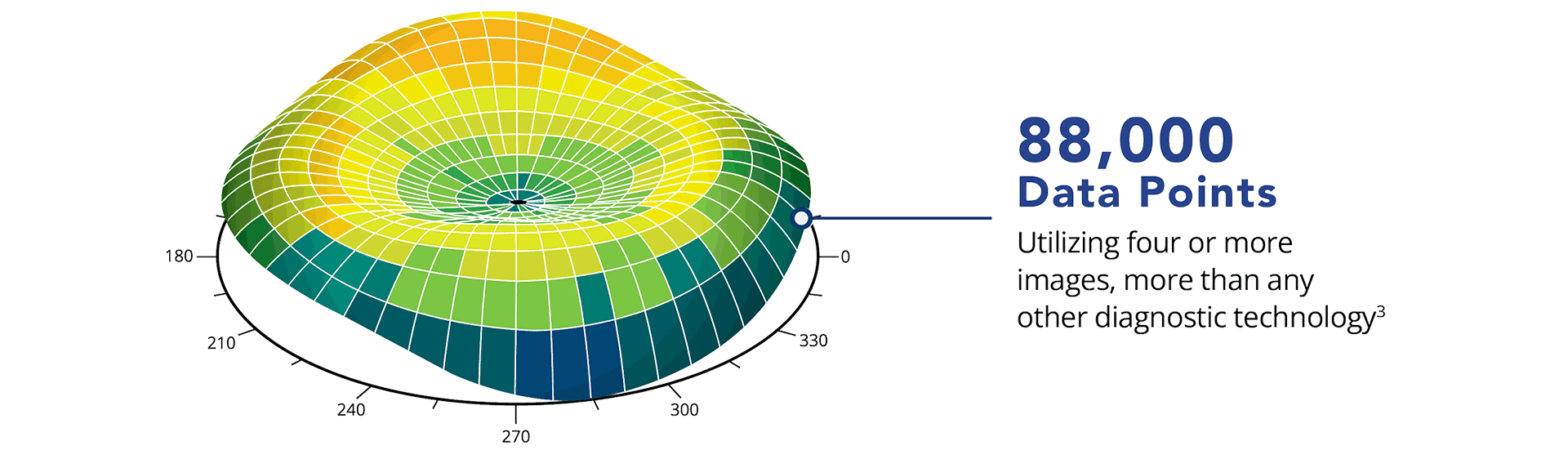 A Contoura Vision corneal topography map capturing 88,000 data points, using four or more images - more than any other diagnostic technology