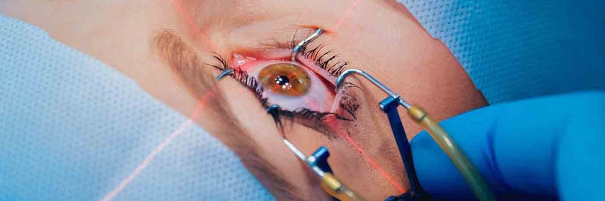 Laser treatment eye YAG laser
