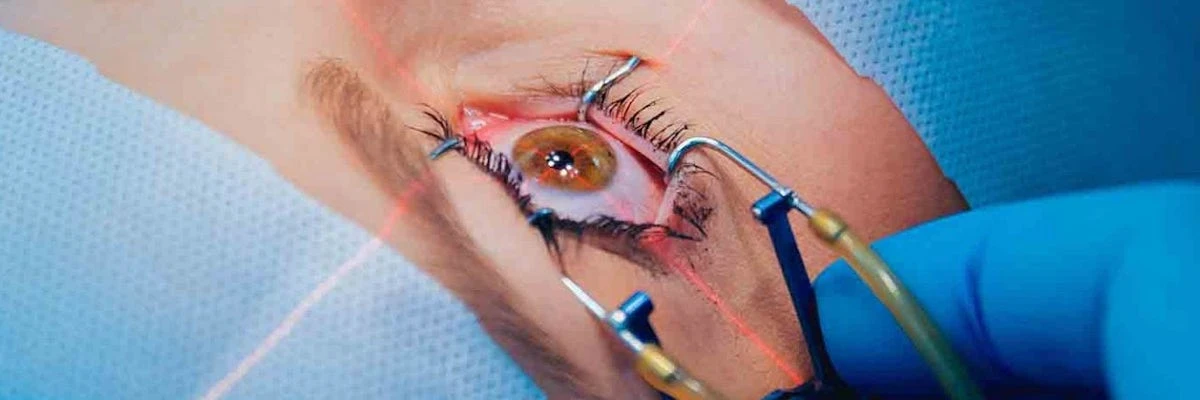Why People Get Laser Eye Surgery Why People Get Laser Eye Surgery